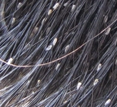 Çocuklarda Kepek Belirtileri ve Tedavisi Çocuklarda Kepek Belirtileri ve Tedavisi