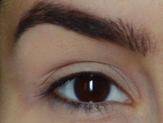 Kaşta Kepek Belirtileri ve Tedavisi